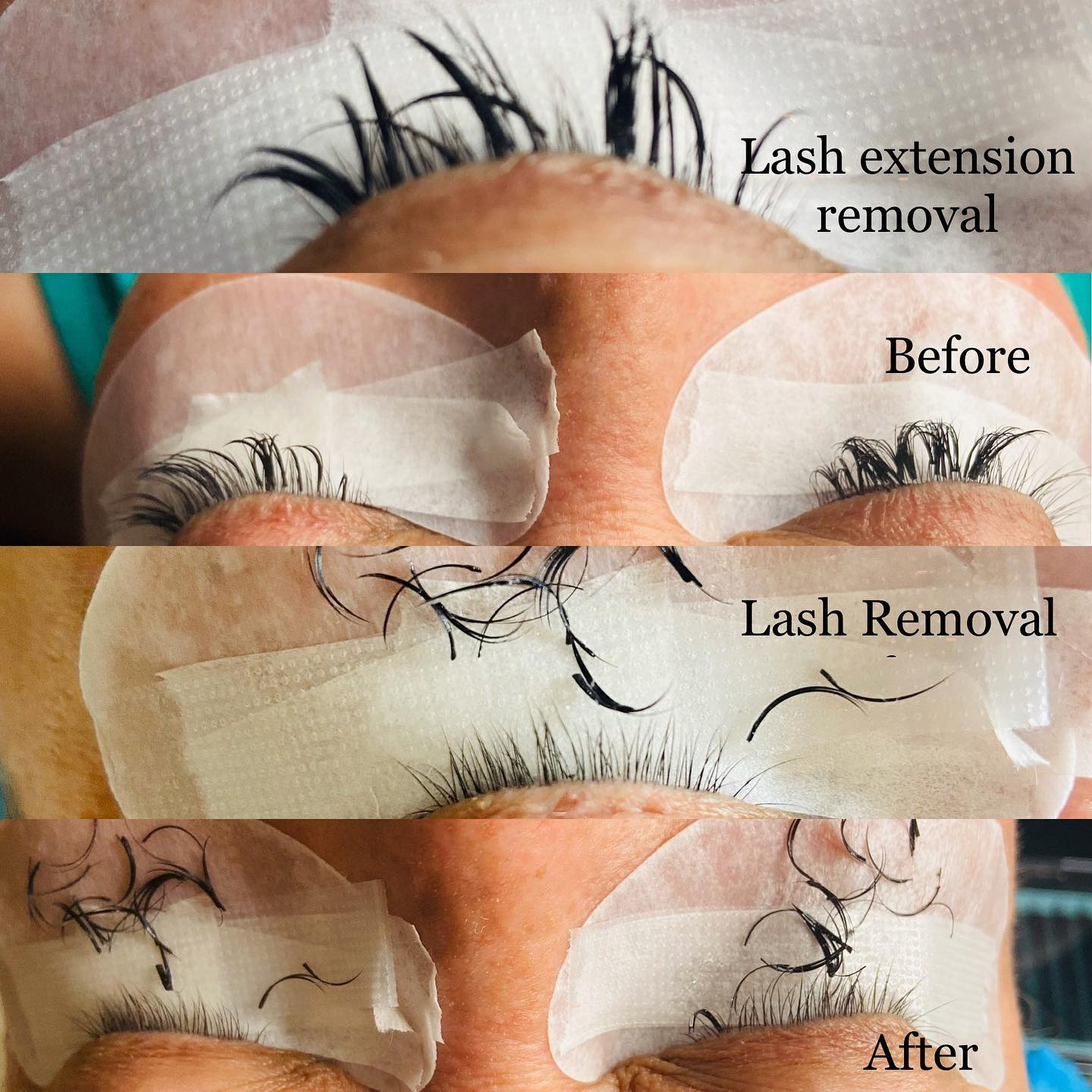 How to Remove lash Extensions
