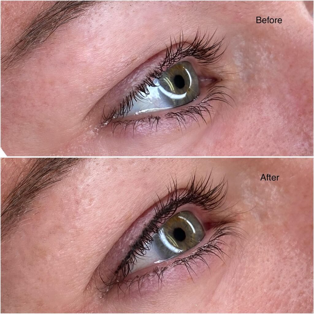 Lash line enhancement Before and After
